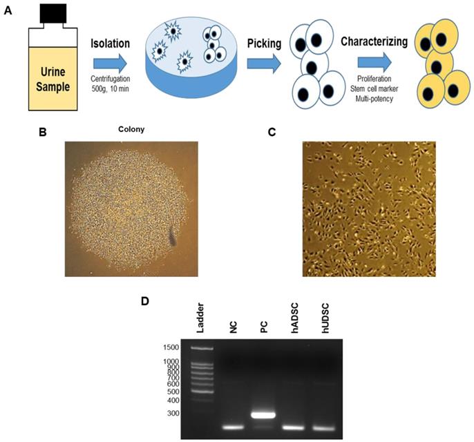 Direct differentiation of insulinproducing cells from human urinederived stem cells