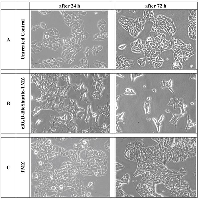 MCF 7 Cells