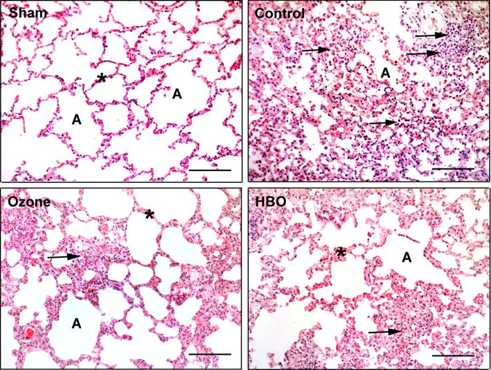 Lung Microscope Slide