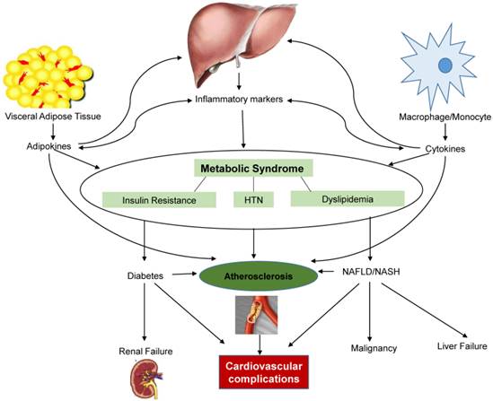 literature review metabolic syndrome