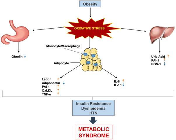 literature review metabolic syndrome