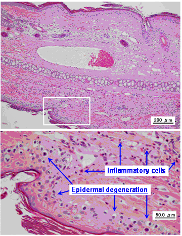 Methods of preventing vinorelbine-induced phlebitis: an experimental ...