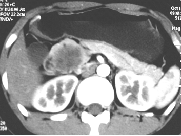 Int J Med Sci Image