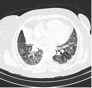 Int J Med Sci Image