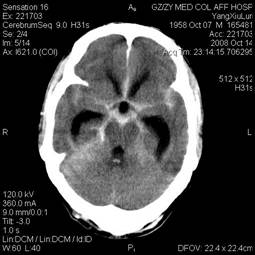 Int J Med Sci Image