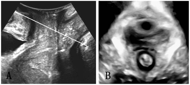 Int J Med Sci Image