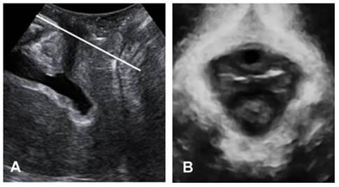 Int J Med Sci Image