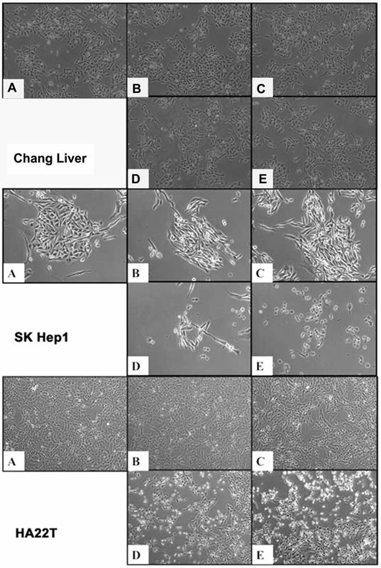 SK-Hep-1 Cell Lines Complete Growth Medium