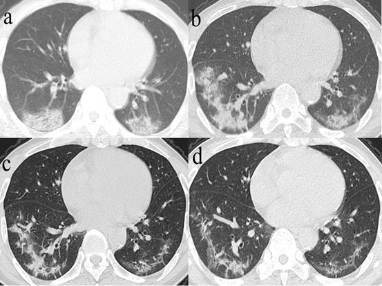 Int J Med Sci Image