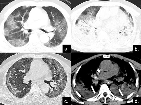 Int J Med Sci Image