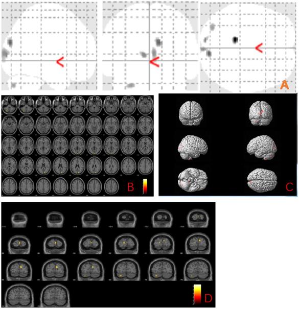 Int J Med Sci Image