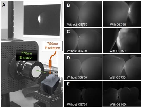 Int J Med Sci Image