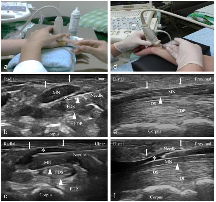 Int J Med Sci Image