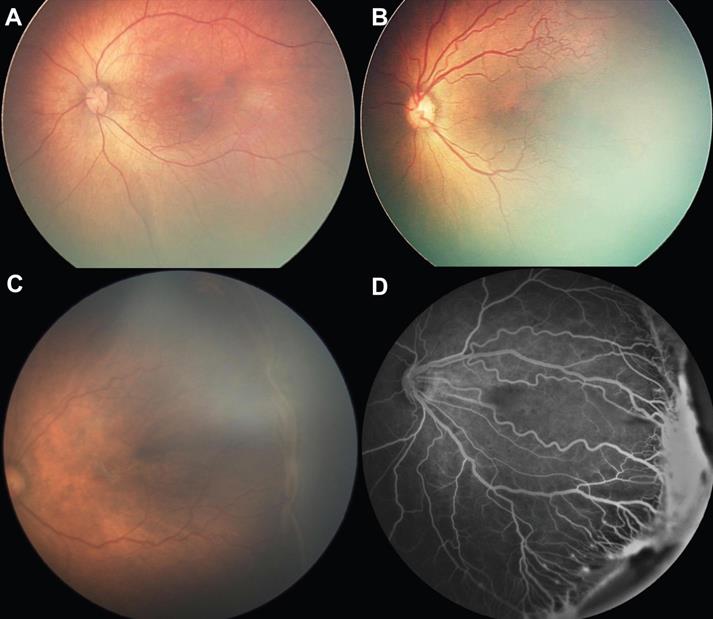 Int J Med Sci Image