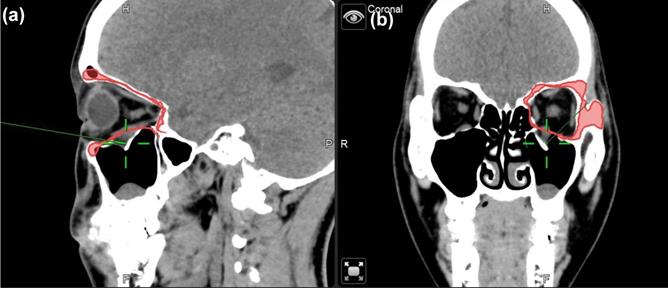 Int J Med Sci Image