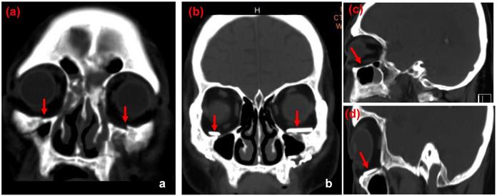 Int J Med Sci Image