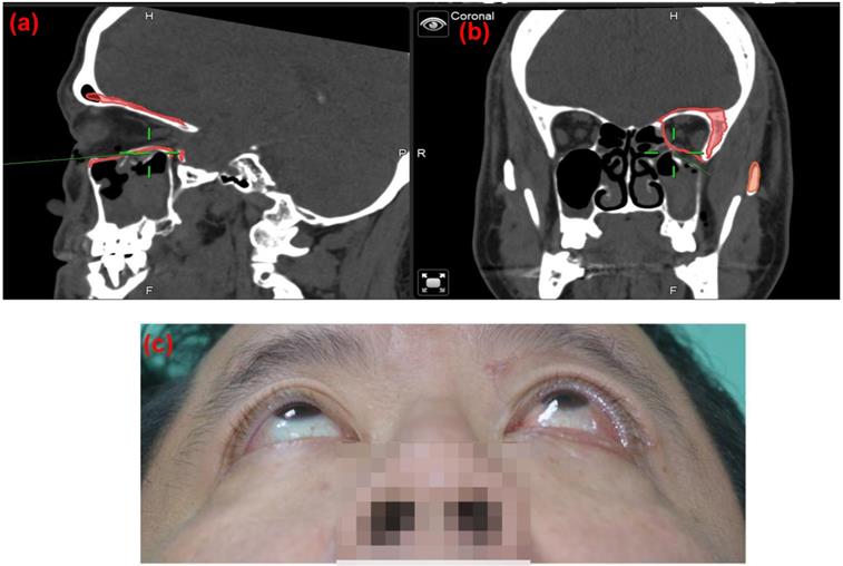 Int J Med Sci Image