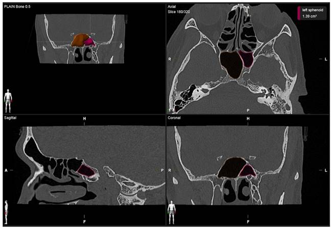 Int J Med Sci Image