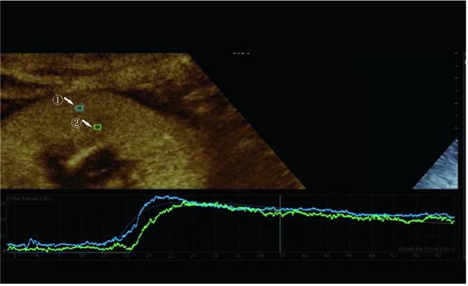 Int J Med Sci Image