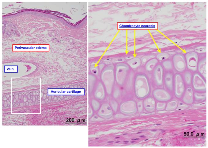 Effect of corticosteroids on phlebitis induced by intravenous infusion ...