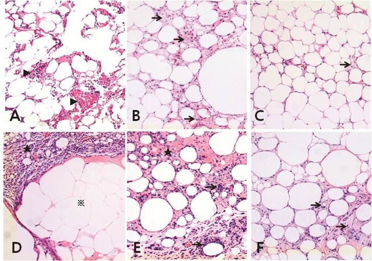 adipose tissue stereology