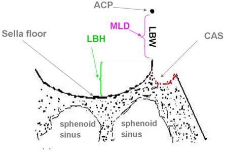 Anatomical Analysis on the Lateral Bone Window of the Sella Turcica: A