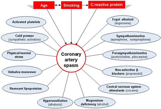 Coronary Artery Spasm: Review and Update