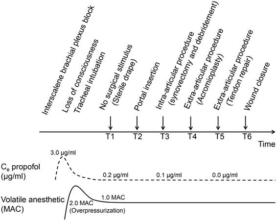 Comparison Of The Analgesic Properties Of Sevoflurane And Desflurane Using Surgical Pleth Index At Equi Minimum Alveolar Concentration