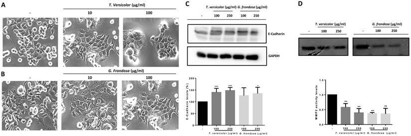 In Vitro Anti Proliferative And Anti Invasive Effect Of Polysaccharide Rich Extracts From Trametes Versicolor And Grifola Frondosa In Colon Cancer Cells