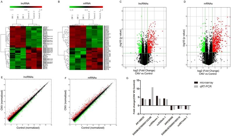 Altered Long Non Coding Rnas Involved In Immunological Regulation And Associated With Choroidal Neovascularization In Mice