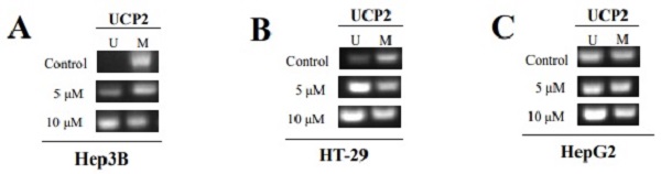 MSP for p15 methylation. Primers were for M sequence respectively