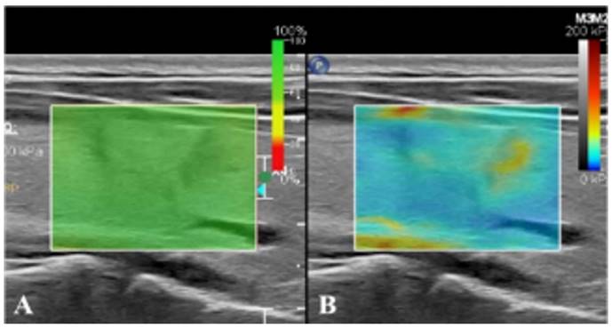 Int J Med Sci Image