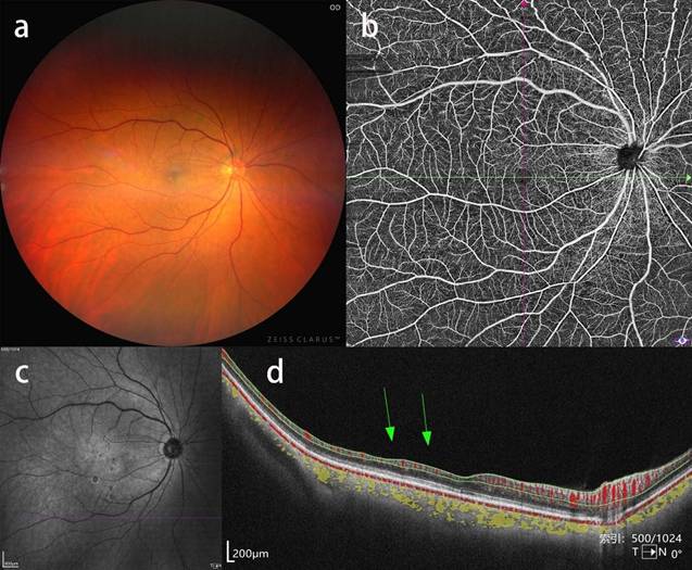 Int J Med Sci Image