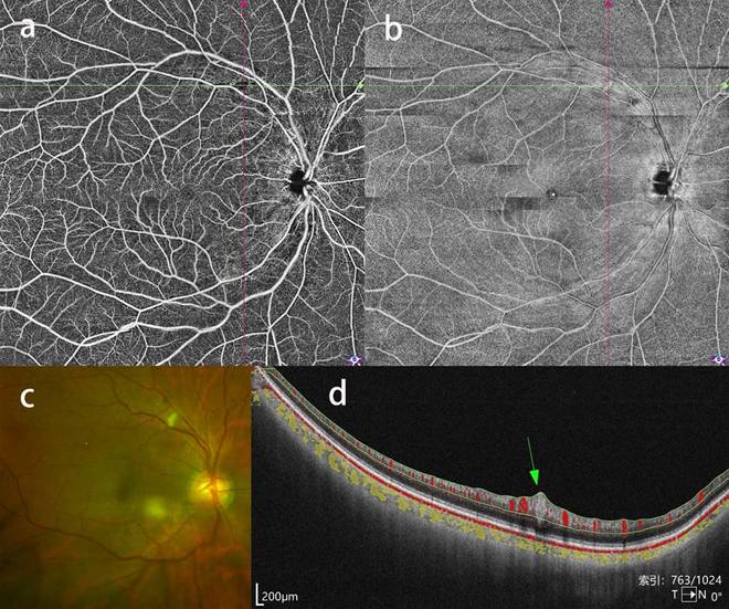 Int J Med Sci Image