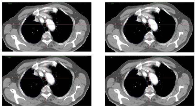 Int J Med Sci Image